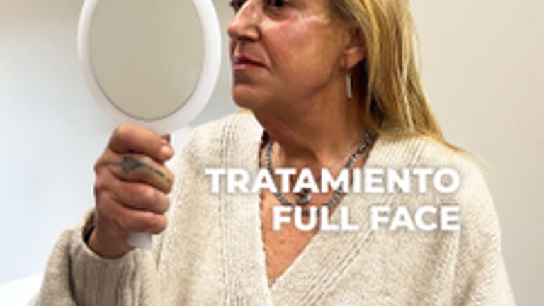 Total face - Clínica Opción Médica