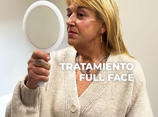 Total face - Clínica Opción Médica