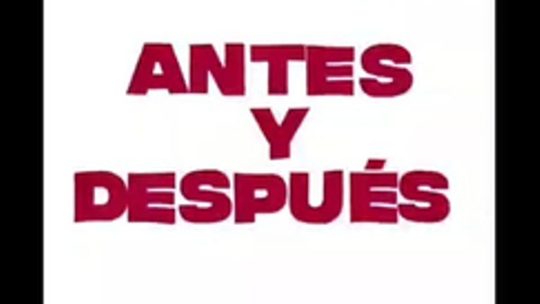 Eliminación de arrugas - Grupo Médico Clínicas Massana