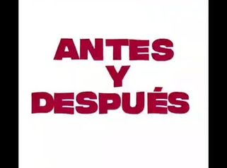 Eliminación de arrugas - Grupo Médico Clínicas Massana