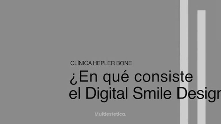 ¿En qué consiste el Digital Smile Design (DSD)?