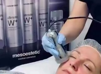 Tratamientos faciales  para dar luminosidad a la piel . Especial eventos