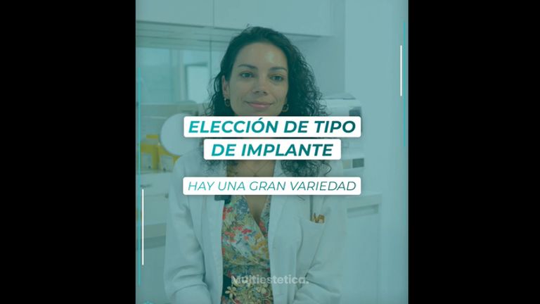 Elección de tipo de implante - Dra. Estefanía Poza Guedes