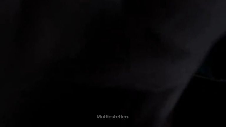 Rinoplastia ultrasónica de precisión con guías 3D
