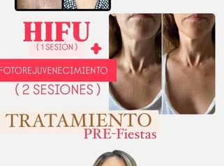 Medicina Estética Coimbra - Hifu