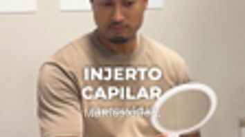 Microinjerto Capilar - Clínica Opción Médica