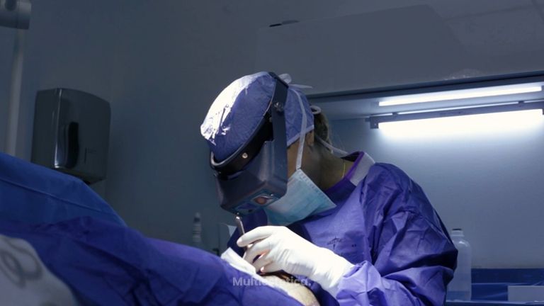 Conoce en qué consiste el microimplante capilar