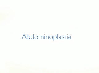 Abdominoplastia 