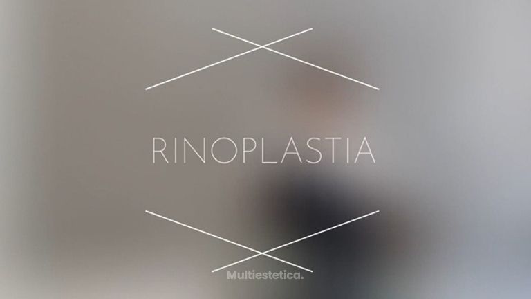 Rinoplastia