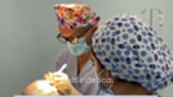 ¿Estás pensando en un Trasplante Capilar?