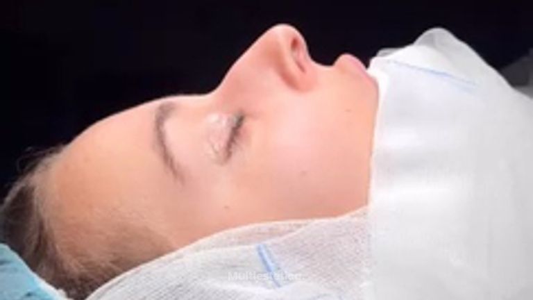 Antes y después inmediato y resultado a los 7 días