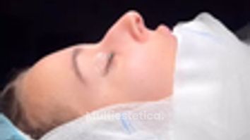 Antes y después inmediato y resultado a los 7 días