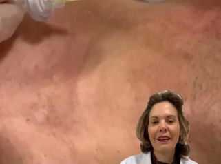 💫 El Cuello- la zona olvidada 💫PROTOCOLOS DE REJUVENECIMIENTO, remodelación y reafirmación.