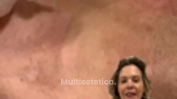 💫 El Cuello- la zona olvidada 💫PROTOCOLOS DE REJUVENECIMIENTO, remodelación y reafirmación.