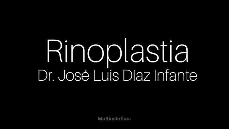 Rinoplastia - Dr. José Luis Díaz Infante
