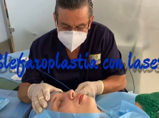 Blefaroplastia - Her Láser