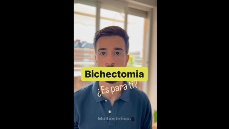 Bichectomía - Dr. Flecha