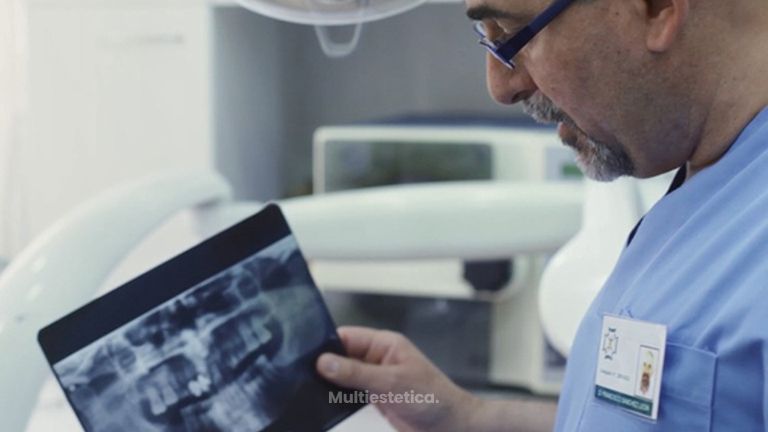 Los implantes dentales, cuestión estética y funcional