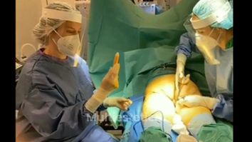 Lipofilling glúteo - Dra. Ana Martinez Padilla