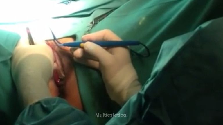 Soluciona tus problemas íntimos de la zona genital