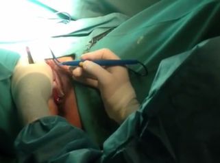 Soluciona tus problemas íntimos de la zona genital