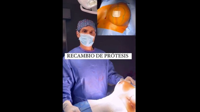 Recambio de prótesis - Clínica Dr. Jiménez