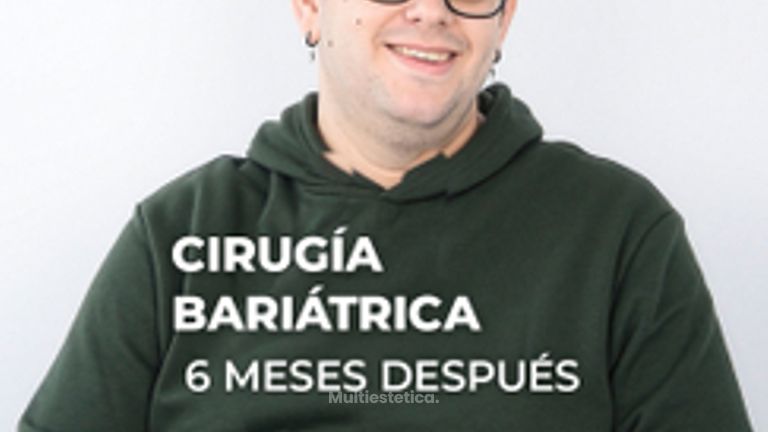 -56 kg en 6 meses - Clínica Opción Médica