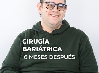 -56 kg en 6 meses - Clínica Opción Médica