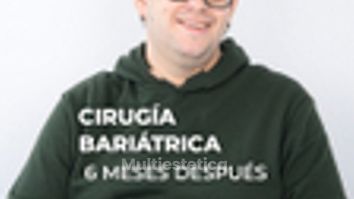 -56 kg en 6 meses - Clínica Opción Médica