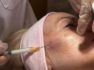 ¡asistimos a un tratamiento de hidratación para prevenir la flacidez!