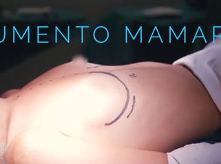 Aumento de pecho