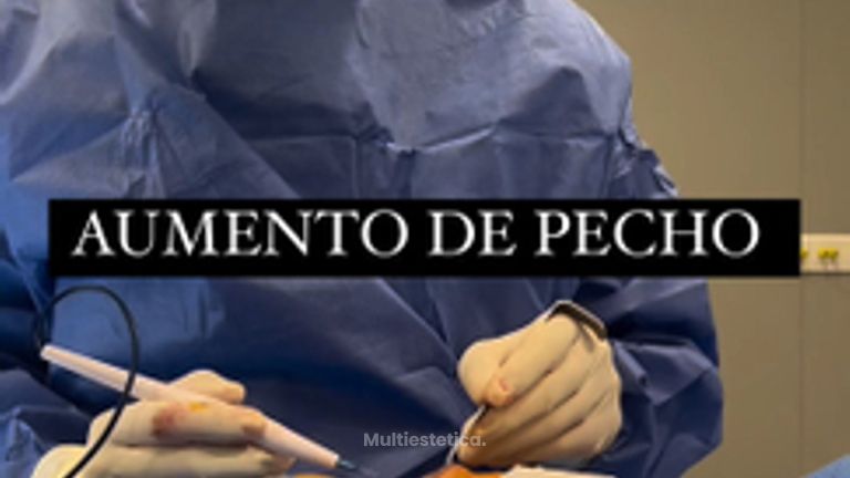 Aumento de pecho - Clínica Dr. Jiménez
