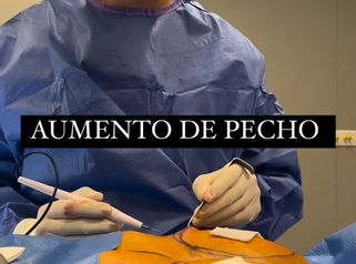 Aumento de pecho - Clínica Dr. Jiménez