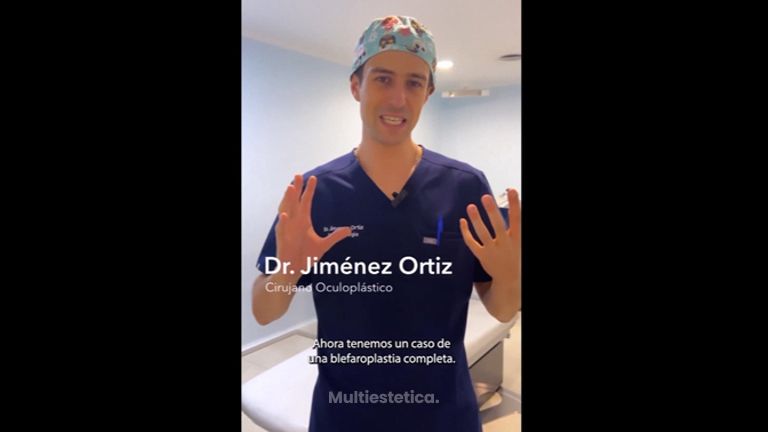 Blefaroplastia - Dr. Jiménez Ortiz