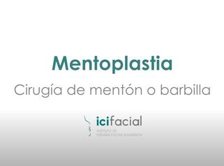 Mentoplastia: Cirugía del mentón o barbilla por Dr. Macia Colón de Icifacial