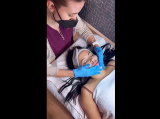 Tratamiento IPL para la rosácea - Aura Clínica