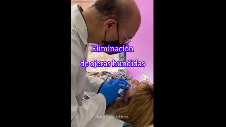 Eliminación de ojeras - Clínica Suárez