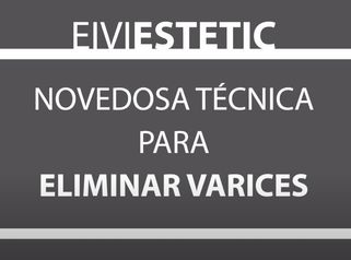 Novedosa técnica para ELIMINAR VARICES - Eiviestetic Grupo Policlinica