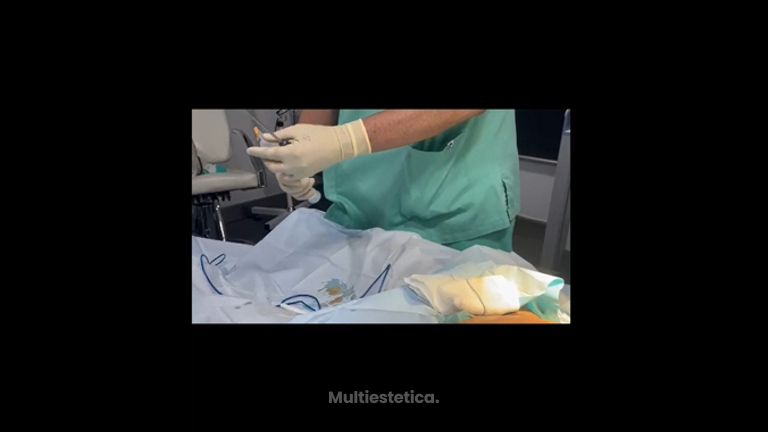 Labioplastia - Dr. José Luis Díaz Infante