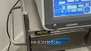 Skn clinic by Leo - Eliminación de acúmulos grasos en la región abdominal con tecnología láser