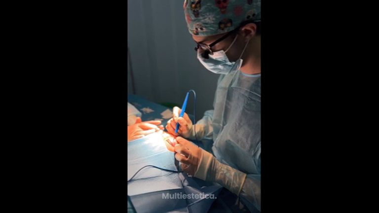 Blefaroplastia - Dr. Jiménez Ortiz
