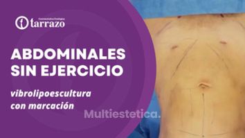 Marcación abdominal - Clínica Tarrazo